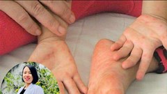 BS khoa Nhi cảnh báo dấu hiệu virus tấn công tế bào thần kinh, cha mẹ không được bỏ qua