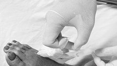 Chuyên gia nuôi rắn hổ mang bị chính “đối tác” cắn nhập viện, phải dùng 30 lọ huyết thanh