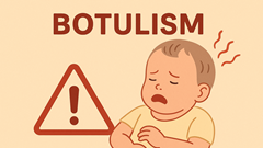 Cần xử lý ra sao khi nghi ngờ trẻ nhiễm botulism?