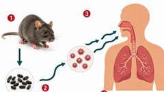 Virus Hanta gây lo ngại toàn cầu: Lây từ chuột, dễ nhầm cúm thường