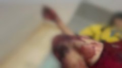  4 học sinh bị thương vì tự chế tạo pháo nổ