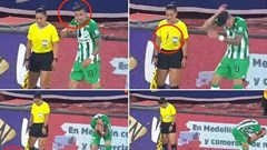 Sốc: Cầu thủ Uruguay bị ‘phóng dao’ trúng đầu khi đang thi đấu