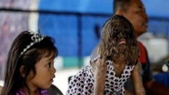 Cô bé “người sói” hiện ra sao?