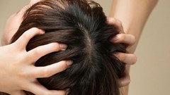 Bác sĩ cảnh báo 5 thành phần “độc hại” trong dầu gội cần tránh