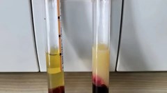 Vì sao tôi luôn kiểm soát mỡ máu nhưng khi khám lại vẫn không cải thiện, thậm chí bị nặng hơn?