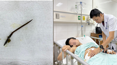 Nhiễm trùng ruột vì nuốt phải tăm