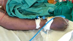 Nghi ăn lòng lợn, người đàn ông nhập viện nguy kịch