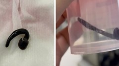 Cẩn trọng ký sinh trùng sống trong mũi trẻ vì tắm suối