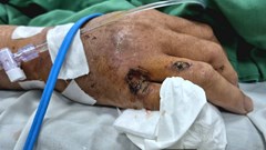 Cảnh báo bị điện giật khi sửa bồn nước trên tầng thượng