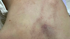 Tổng đài bảo vệ trẻ em 111 vào cuộc vụ nghi bạo hành trẻ em ở phường Bồ Đề