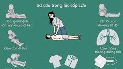 4 việc cần làm và 5 việc cần tránh khi sơ cứu người đột quỵ tại nhà