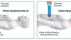 Ưu thế vượt trội của “siêu máy” điều trị ung thư Việt Nam vừa đặt mua của Mỹ