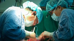 Dấu ấn ghép tạng: 21 bệnh nhân được hồi sinh trong một tuần