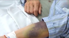 Sốt cao liên tục, hết sốt chưa hết nguy hiểm: Cảnh giác bệnh truyền nhiễm này