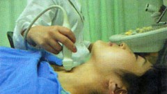 Nguyên nhân ung thư tuyến giáp ngày càng tăng nhưng giảm tỷ lệ tử vong