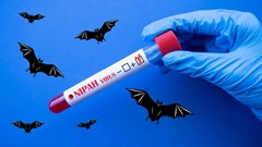 Bác sĩ Bệnh viện Bạch Mai nói thẳng về virus Nipah