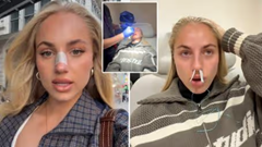 Nữ cầu thủ xinh đẹp nhất thế giới bị chị gái húc gãy mũi