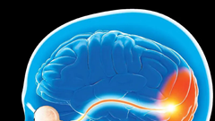 Võng mạc nhân tạo