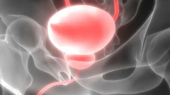 Hé lộ cơ chế hình thành ung thư tuyến tiền liệt