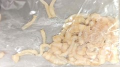 Phát hiện sán dây dài 3 mét sống trong ruột sau gần 1 năm đau bụng âm ỉ