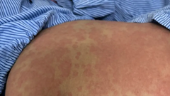 Nguy kịch sau khi dùng thuốc giảm cân thải độc không rõ nguồn gốc