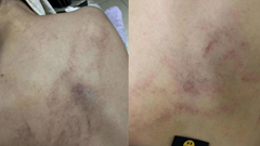 Đình chỉ cô giáo bị tố dốc ngược đầu trẻ, ném xuống giường ở Trường Mầm non Gia Thụy