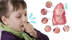 TP.HCM ghi nhận một trường hợp mắc bệnh ho gà