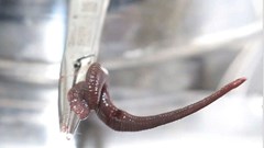 Gia Lai: Gắp con vắt dài 8cm sống trong mũi bệnh nhân suốt một tuần