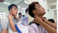  “Bắt pen” ở giới trẻ, trò chơi vô cùng nguy hiểm, có thể tử vong