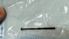 Gắp thành công một đinh vít dài 4cm trong dạ dày bệnh nhi 3 tuổi