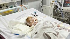 Bé trai xuất huyết não bất thường tại cơ sở giữ trẻ tự phát
