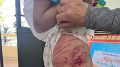 Các vụ bạo hành trẻ em gần đây gây bức xúc dư luận
