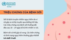 Nghệ An: Gần 1.100 ca sốt phát ban nghi sởi, nguy cơ bùng phát dịch