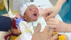 Xót xa bé gái sơ sinh bị bỏ rơi trong bao tải giữa cánh đồng