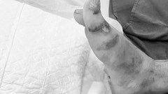 Người đàn ông bị bỏng nặng vì thả diều gần đường dây điện cao thế