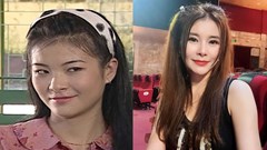 Nữ NSƯT từng đóng vợ anh Núi: U50 chi 1 tỉ đồng sang Hàn đại phẫu nhan sắc, chọn sống độc thân
