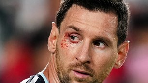 Messi rách mí mắt vì khuỷu tay Xhaka, vẫn chiến đấu đưa Argentina vào bán kết