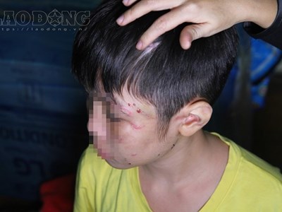Xét xử vụ cha ruột mẹ kế bạo hành con trai rạn xương sườn: "Bố có hối hận không?"