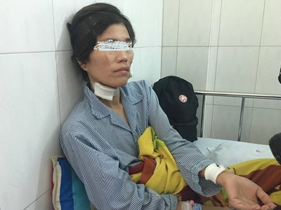 Vụ cắt tai vợ cũ ở Quảng Nam: Chồng thừa nhận do mâu thuẫn tiền bạc