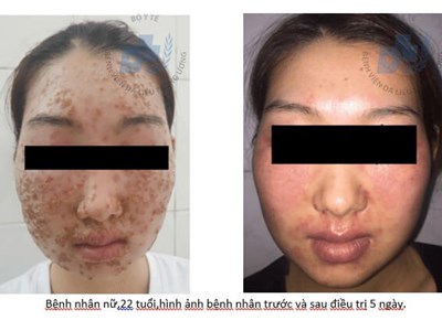 Vì sao họ cứ “điếc không sợ súng”?