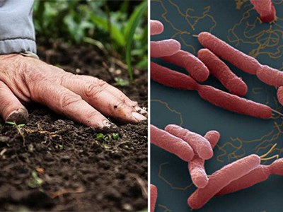 Gia tăng số ca mắc Whitmore tại miền Trung