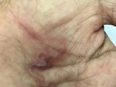 Cẩn trọng nhiễm ký sinh trùng từ thú cưng