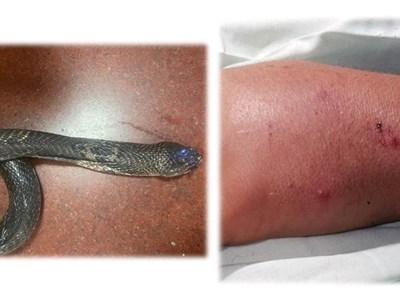 Cảnh báo rắn độc trú ẩn trong vườn cây, bụi cỏ tại khu dân cư