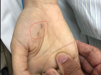 Một bác sĩ thú y tử vong vì bị chó dại cắn