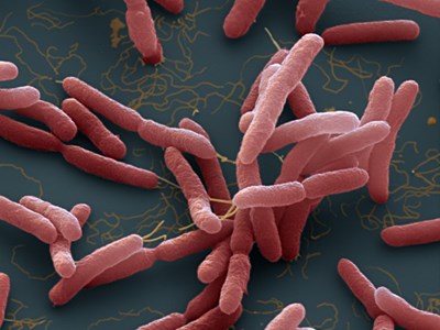 Hai bệnh nhi ở Quảng Trị nhiễm vi khuẩn gây bệnh Whitmore