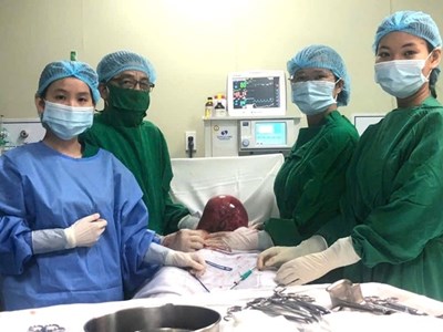 Bệnh viện Quân y 121 phẫu thuật thành công khối u xơ tử cung khoảng 4,5kg