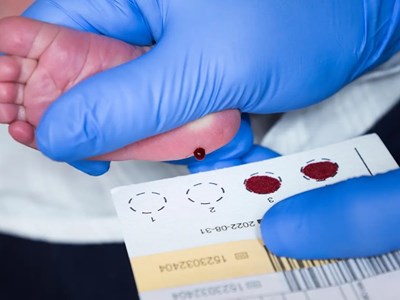 Anh sẽ sàng lọc bệnh teo cơ tủy sống cho tất cả trẻ sơ sinh từ năm 2027