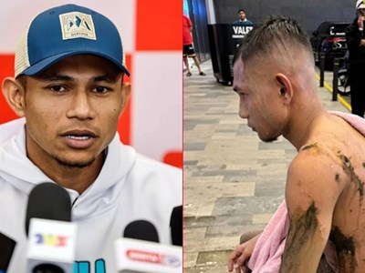 Tuyển thủ Malaysia bị tạt axit