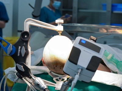 Robot AutoGuide lần đầu xuất hiện tại Việt Nam: Bước ngoặt công nghệ trong điều trị động kinh