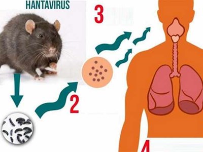 Bộ Y tế cảnh báo khẩn về bệnh do virus Hanta khiến 3 người tử vong trên tàu du lịch, Việt Nam chưa ghi nhận ca bệnh